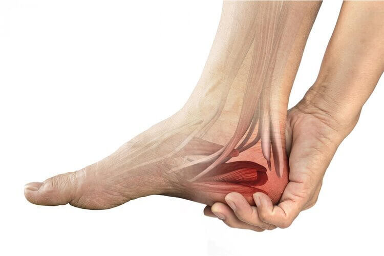 Heel pain treatment in the Toronto, Ontario, M3H 3S3 area